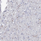 Immunohistochemical staining of human heart muscle shows moderate positivity in intercalated discs in myocytes.