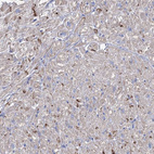 Immunohistochemical staining of human heart muscle shows strong positivity in intercalated discs in myocytes.