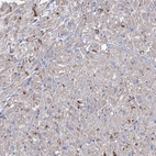 Immunohistochemical staining of human heart muscle shows strong positivity in intercalated discs in myocytes.