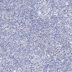 Immunohistochemical staining of human tonsil shows no positivity in non-germinal center cells as expected.
