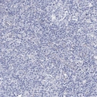Immunohistochemical staining of human tonsil shows no positivity in non-germinal center cells as expected.