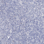 Immunohistochemical staining of human tonsil shows no positivity in non-germinal center cells as expected.
