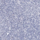 Immunohistochemical staining of human tonsil shows no positivity in non-germinal center cells as expected.