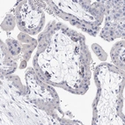 Immunohistochemical staining of human placenta shows no positivity in trophoblastic cells as expected.