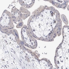 Immunohistochemical staining of human placenta shows no positivity in trophoblastic cells as expected.