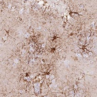 Anti-IFIT5 Antibody