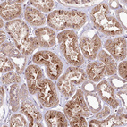 Anti-PHLDB1 Antibody