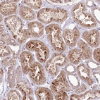 Anti-PHLDB1 Antibody