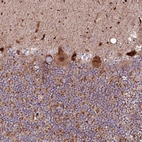 Immunohistochemical staining of human cerebellum shows moderate cytoplasmic and nuclear positivity in Purkinje cells.