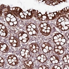 Immunohistochemical staining of human colon shows moderate cytoplasmic positivity in glandular cells.