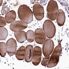 Immunohistochemical staining of human skeletal muscle shows moderate cytoplasmic positivity in myocytes.