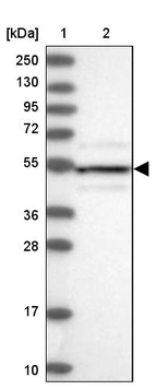 Lane 1: Marker [kDa] 250, 130, 95, 72, 55, 36, 28, 17, 10_br/_Lane 2: Human cell line RT-4
