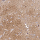 Immunohistochemical staining of human Cerebral cortex shows moderate positivity in neuropil.