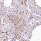 Immunohistochemical staining of human Testis shows moderate cytoplasmic positivity in Leydig cells.