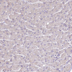 Immunohistochemical staining of human Liver shows no positivity in hepatocytes as expected.