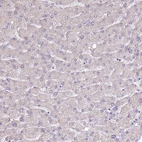 Immunohistochemical staining of human Liver shows no positivity in hepatocytes as expected.