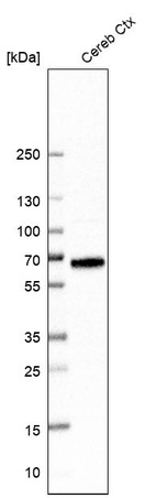 Western blot analysis in human cerebral cortex tissue.
