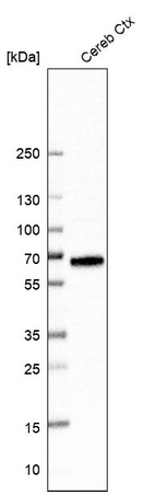 Anti-SLC6A11 Antibody