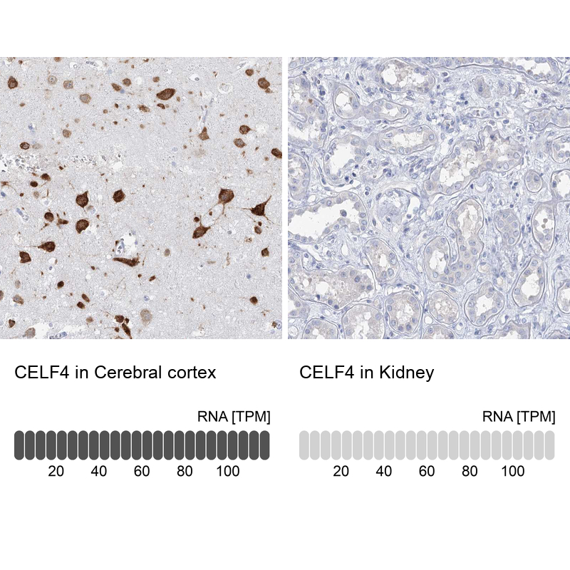 Anti-CELF4 Antibody