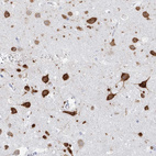 Immunohistochemical staining of human cerebral cortex shows moderate cytoplasmic positivity in neurons.