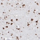 Immunohistochemical staining of human cerebral cortex shows moderate cytoplasmic positivity in neurons.
