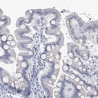 Immunohistochemical staining of human duodenum shows no positivity in glandular cells as expected.