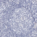 Immunohistochemical staining of human lymph node shows no positivity in lymphoid cells as expected.