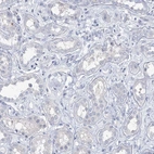 Immunohistochemical staining of human kidney shows no positivity in cells in tubules as expected.