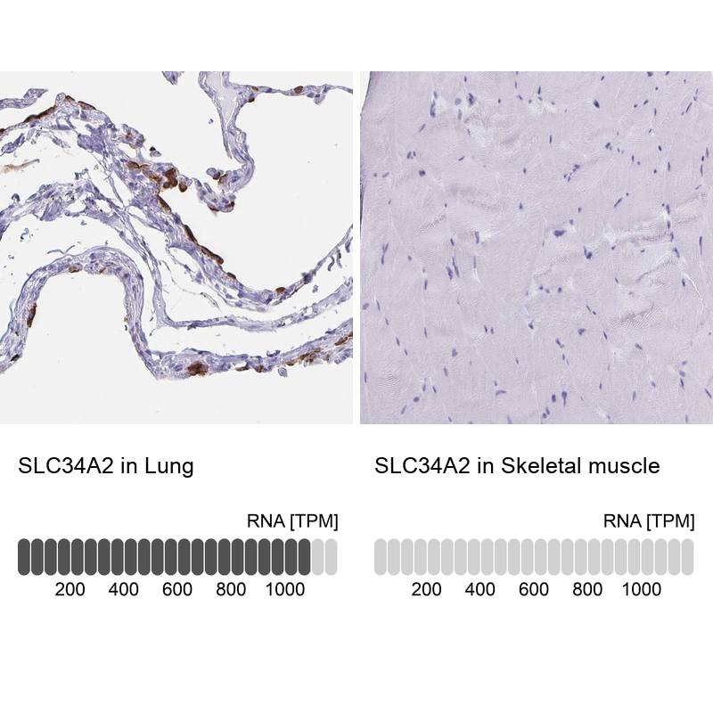 Anti-SLC34A2 Antibody