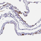 Immunohistochemical staining of human lung shows strong membranous positivity in a subset of pneumocytes.