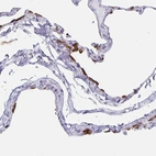 Immunohistochemical staining of human lung shows strong membranous positivity in a subset of pneumocytes.