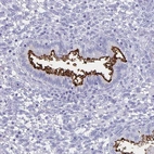 Immunohistochemical staining of human endometrium shows strong positivity in apical membrane in glandular cells.