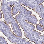 Immunohistochemical staining of human fallopian tube shows strong positivity in apical membrane in glandular cells.