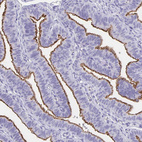 Anti-SLC34A2 Antibody