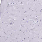 Immunohistochemical staining of human skeletal muscle shows no positivity in myocytes as expected.
