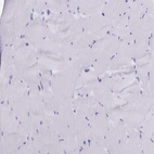 Immunohistochemical staining of human skeletal muscle shows no positivity in myocytes as expected.