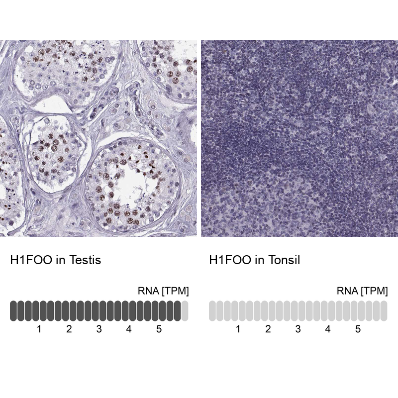 Anti-H1FOO Antibody