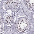 Immunohistochemical staining of human Testis shows moderate nuclear positivity in spermatids.