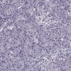 Immunohistochemical staining of human Pancreas shows no positivity in exocrine glandular cells as expected.