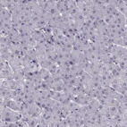 Immunohistochemical staining of human Liver shows no positivity in hepatocytes as expected.
