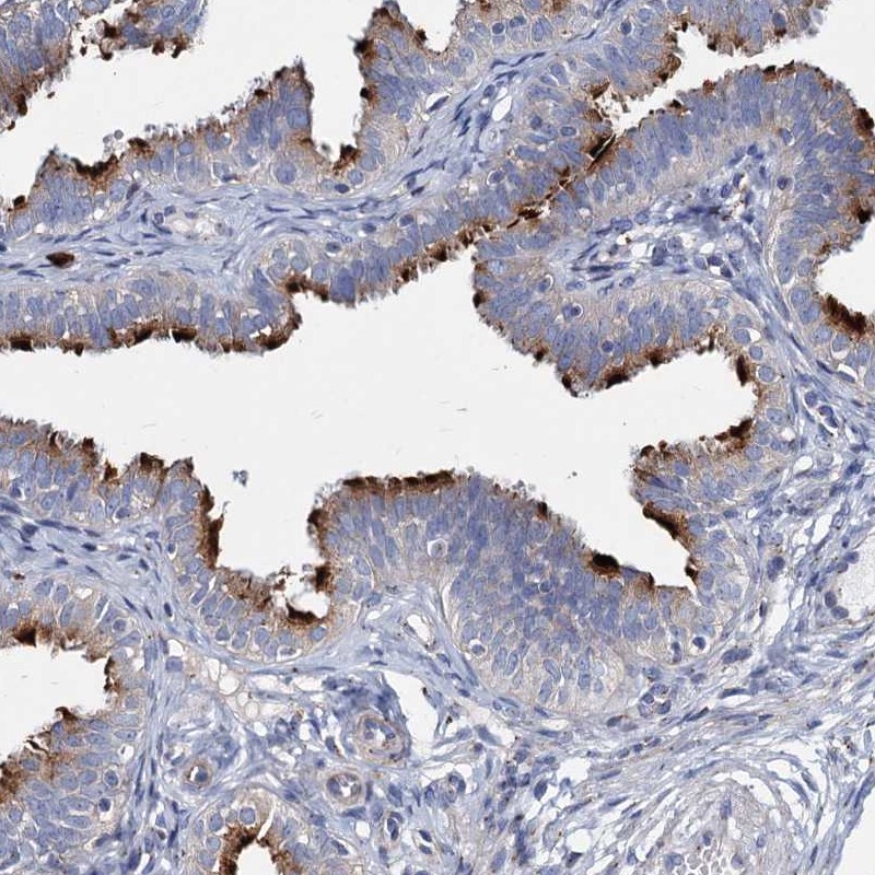 Anti-AGBL4 Antibody