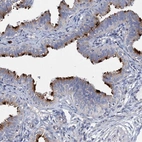 Anti-AGBL4 Antibody