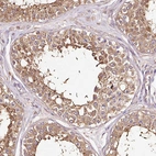 Anti-METAP1 Antibody