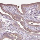 Immunohistochemical staining of human fallopian tube shows weak cytoplasmic and membranous positivity in glandular cells.