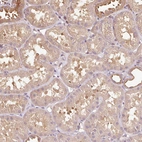 Immunohistochemical staining of human kidney shows moderate cytoplasmic positivity in cells in tubules.