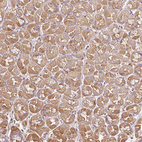 Immunohistochemical staining of human stomach shows moderate cytoplasmic positivity in glandular cells.