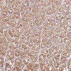 Immunohistochemical staining of human stomach shows moderate cytoplasmic positivity in glandular cells.