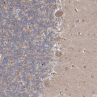 Immunohistochemical staining of human cerebellum shows weak cytoplasmic positivity in Purkinje cells.