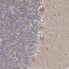 Immunohistochemical staining of human cerebellum shows weak cytoplasmic positivity in Purkinje cells.