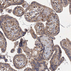 Immunohistochemical staining of human placenta shows moderate cytoplasmic positivity in trophoblastic cells.